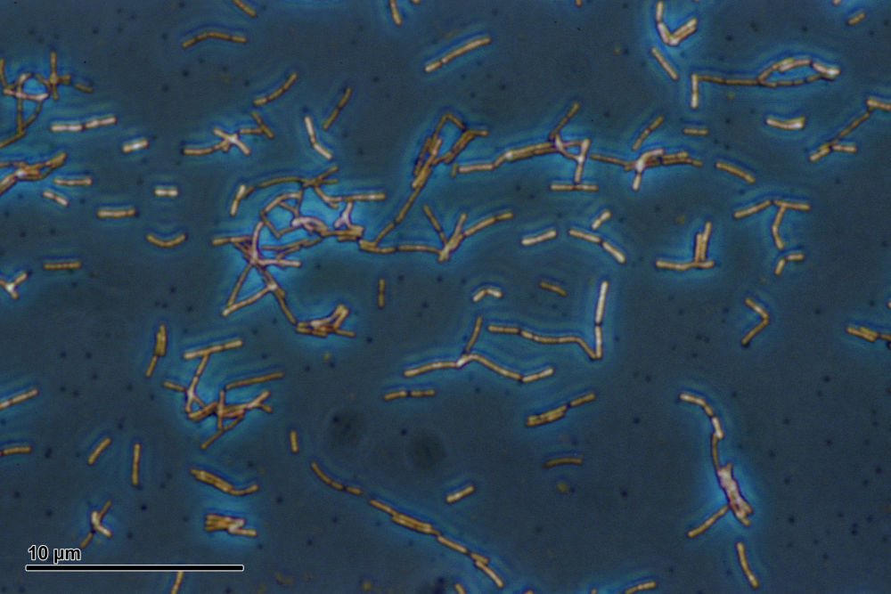 Tyčinkovité bakterie Lactobacillus acidophilus pod mikroskopem