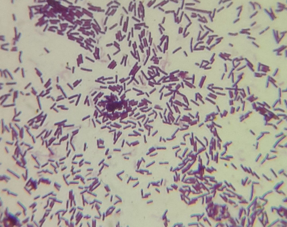 Fialové tyčinkovité bakterie Lactobacillus reuteri obarvené podle Grama